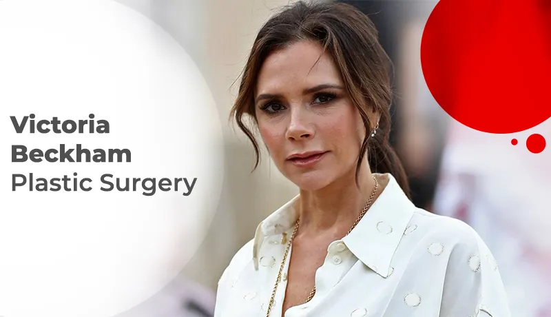 Victoria Beckham